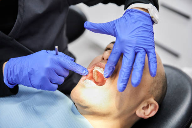 Best Emergency Treatment for Dental Infections or Abscesses in Fairview, OR